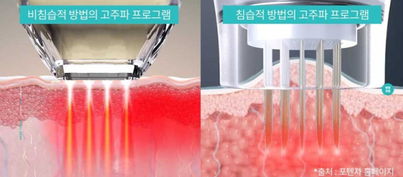 효과 보는 핵심 tip