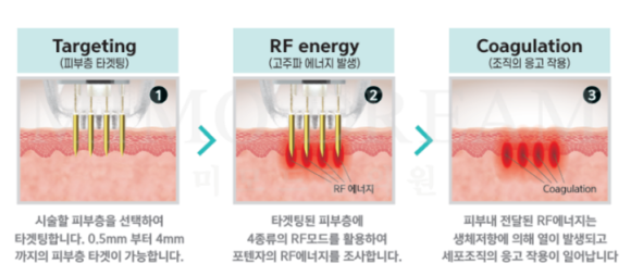 결론