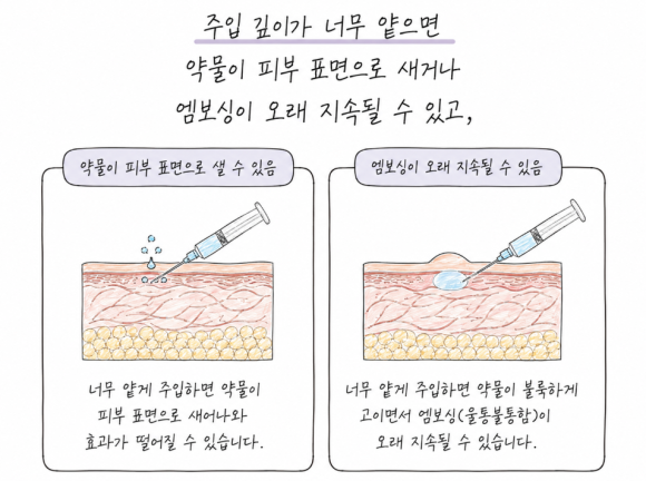 손주사 스킬도 결과를 바꿉니다