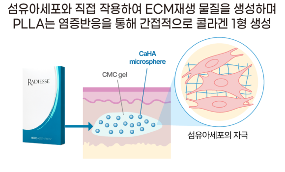 1. 출발점부터 다르다